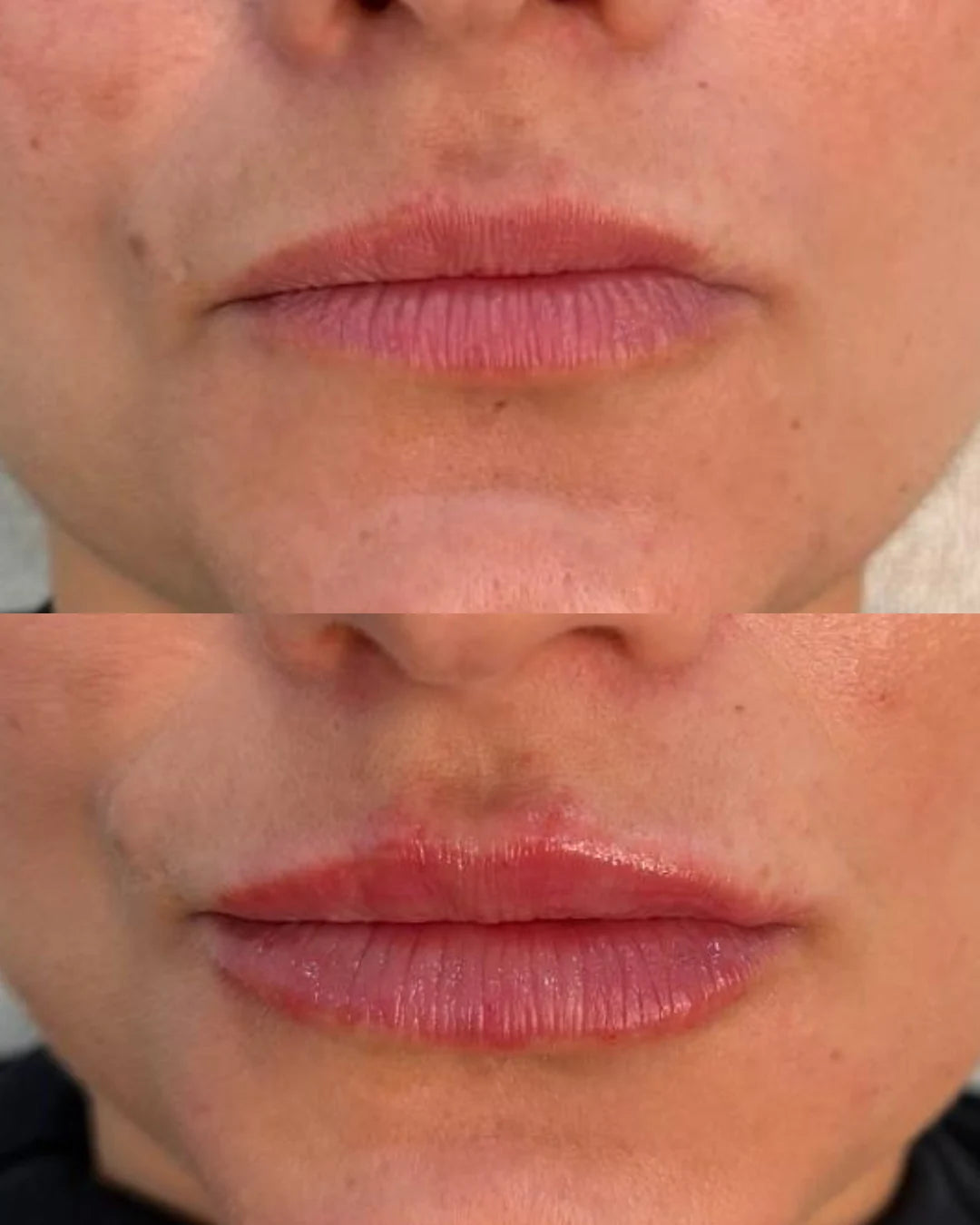 Diseño de labios