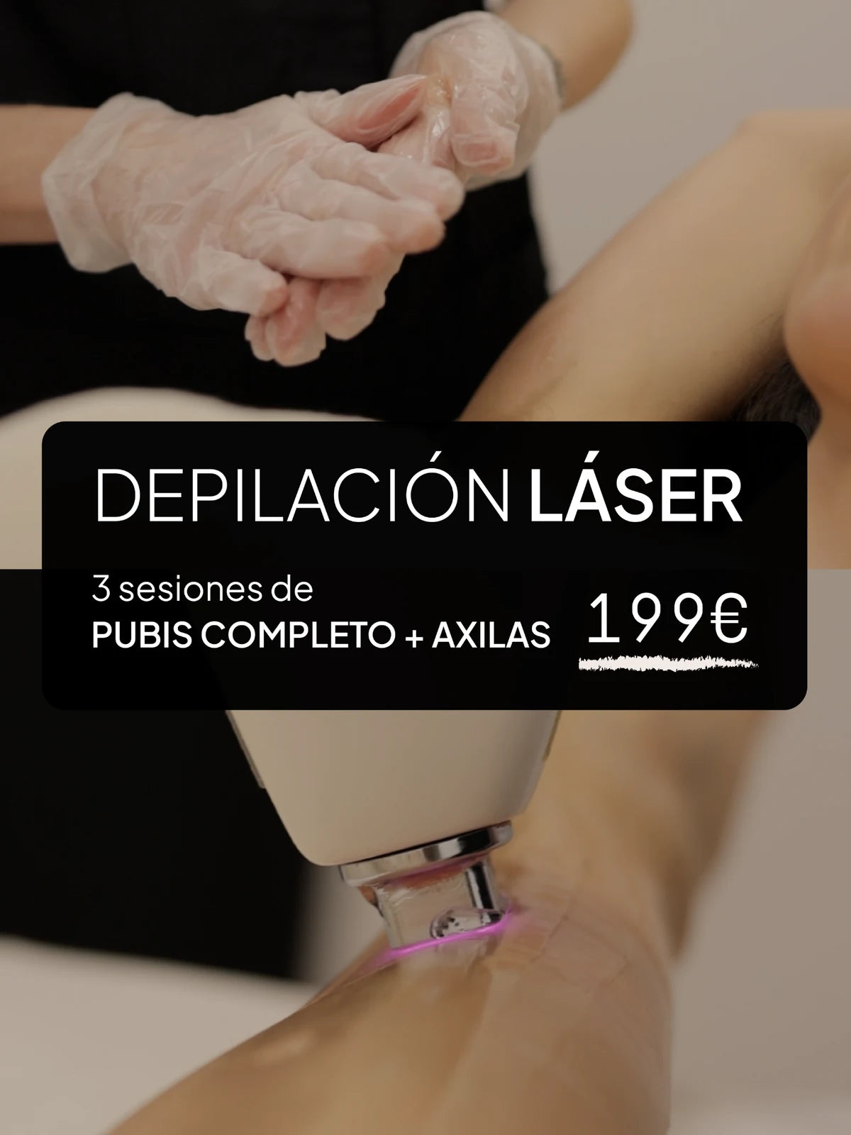 Depilación láser